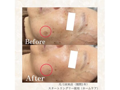 フォルチェ ゆめタウン広島店(Folche)の写真