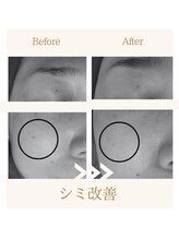 ファミル(FAMIL)/