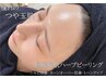 国産ピーリング【ニキビ毛穴ケア】お顔ハーブピーリング¥16500→¥5500