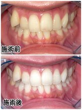 ホワイトニングビューティー 名古屋栄店(WHITENING BEAUTY)/セルフホワイトニング