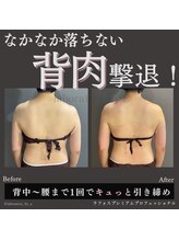 ラボラトリー バイ イー 麻布十番店(laboratory by E)/ラフォスプロ（上半身）【痩身】