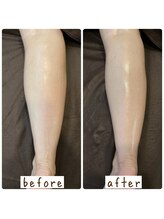 シンシンラボ 豪徳寺(SHINSHIN Lab)/冷え・むくみ対策に！