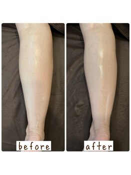 シンシンラボ 豪徳寺(SHINSHIN Lab)/冷え・むくみ対策に!