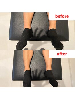 ナオル整体 福岡香椎院(NAORU整体)/20代男性施術事例【右脚の開き】