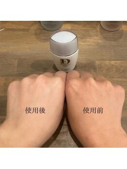 キュオバイアンドリープ(Qo by &LEAP)/日焼け止めビフォーアフター☆