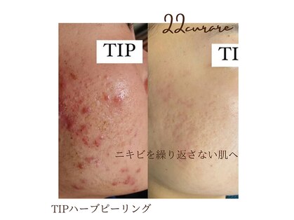 ニジュウニ クラレ(22curare)の写真