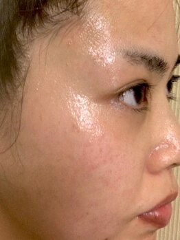 ヌッカ 学芸大学店(Nucca)の写真/全身からビタミン、ミネラルを吸収。ニキビ・敏感肌でお悩みの方にもおすすめ！しっとり艶肌へ導きます◎