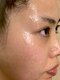 ヌッカ 学芸大学店(Nucca)の写真/全身からビタミン、ミネラルを吸収。ニキビ・敏感肌でお悩みの方にもおすすめ！しっとり艶肌へ導きます◎