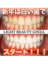 ライトビューティー 銀座店(LightBeauty)/東銀座 ホワイトニング 症例写真