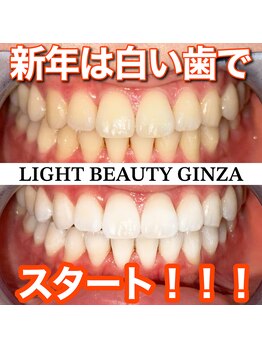 ライトビューティー 銀座店(LightBeauty)/東銀座 ホワイトニング 症例写真
