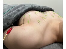 ハリスタ 西宮院(HARISTA)の雰囲気（効果実感の高技術♪）