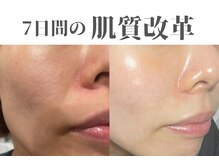 レクシア(LEXIA)の雰囲気（顧客様◎人気No.1あらゆる肌質改善にスピード感と実感艶たまご肌）