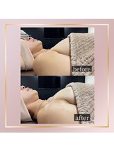 ロザリア(ROSALIA)/デコルテふっくら♪