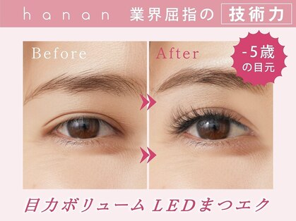 ハナン 札幌大通店(hanan)の写真