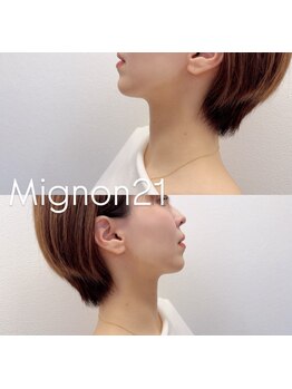 美白ケアをしたい