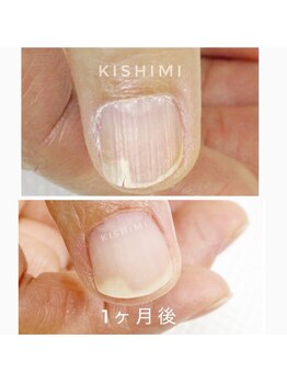 ネイル キシミー(Nail-Kishimi)の写真/お爪のお悩みがある方へ
初めての方限定【お試し¥2,980】自爪育成ネイルケア+補強クリアコート剤