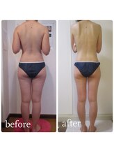 加圧ビューティーサロン スタイル エム(beauty salon style M)/30代/パワーツリー120分のみ