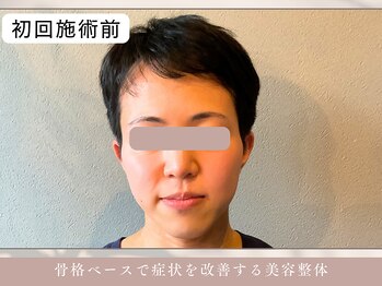 ほぐし屋 かすがい/初回/小顔リフト+美姿勢整体