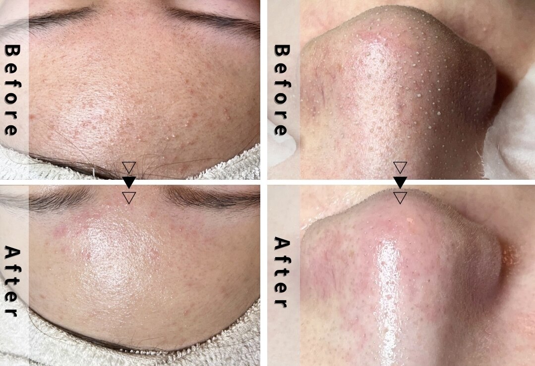 エヌエクラ(N.eclat.)｜ホットペッパービューティー