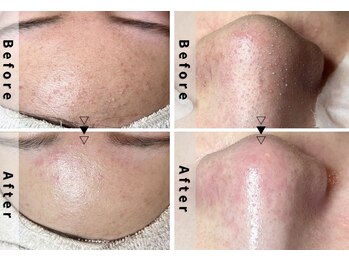 エヌエクラ(N.eclat.)