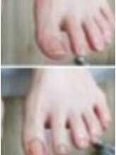 リゼラアンドコー 名古屋栄店【フットケア/巻き爪/足裏角質/爪トラブル】/