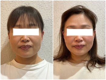 ウェリナ平和堂長久手院/小顔矯正/骨盤矯正/美脚サロン