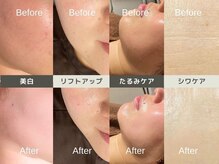 ルディラ 町田店/ルディラ医療提携エステ