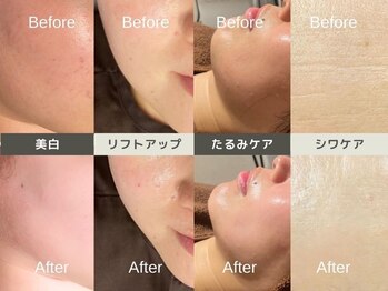 ルディラ 町田店/ルディラ医療提携エステ