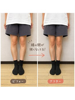 セントラル志木接骨院の写真/”見た目“も”健康“も整える☆有国家資格者が身体の仕組みから考えるX脚・O脚矯正[リンパ,むくみ]