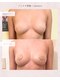 ナナイロ(nanairo)の写真/【切らない新発想バストケア】脂肪増殖ケアでふっくら自然に♪理想のボリューム＆美バストラインへ
