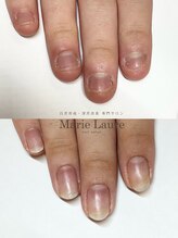 マリーロール 梅田店(Marie Laure)/自爪育成/深爪矯正/ネイルケア