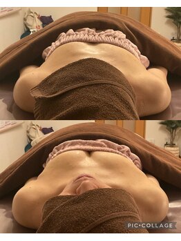 アネラ 京都駅前店(Anela)/【正面のBefore & After】