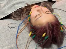 ソウノ 御茶ノ水(Souno)/美容鍼