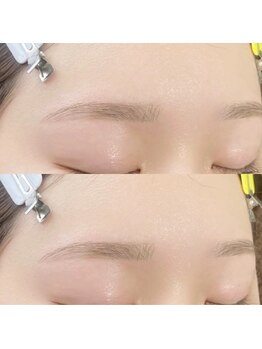 ソレ シャーム(sole charme)/自然平行