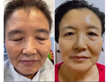 ボディーシェルター 横浜桜木町/ダイヤモンドピール