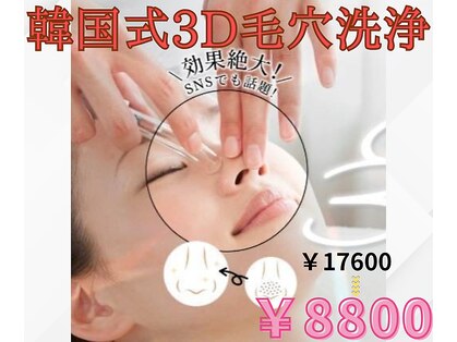 シュエット(Chouette)の写真