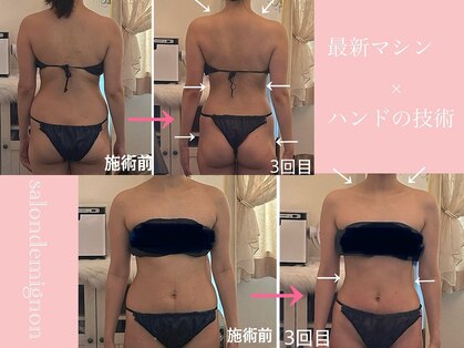 サロン ド ミニョン(salon de mignon)の写真