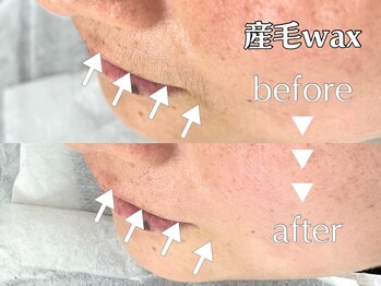 スタジオサンハチゴ(studio-385)/【産毛wax】口まわり