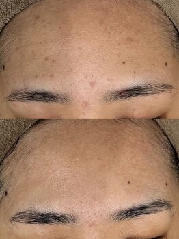 レイニゲン(H/Reinigen)/