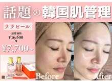 BUB 立川の雰囲気（ララピールなら当サロンが1番お得リサーチ済/毛穴汚れ角質汚れ◎）