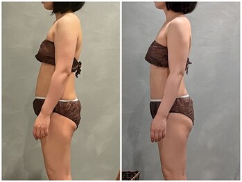 ツーアップ(2up)