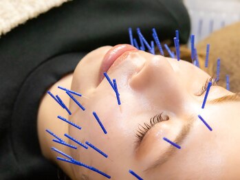ボニー(Bonnie)の写真/【倉敷】骨格×筋肉の両面から整える小顔矯正×美容鍼｜国家資格16年のオーダーメイド施術