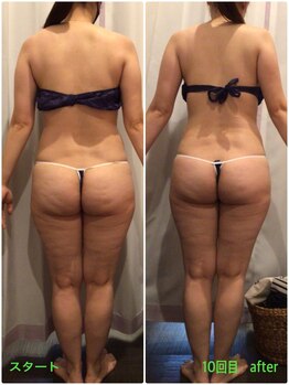 酵素風呂 めぐみ/エンダモロジーと酵素風呂10回