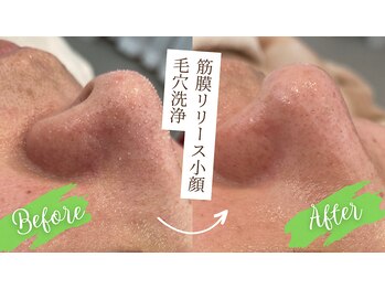 ルー(Lu)/【大人気】毛穴洗浄