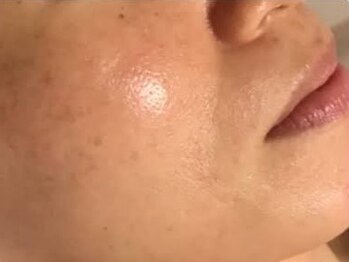 リアフィル(Li’afill)