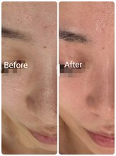 サロン ド ハニー(Salon de Honey)/