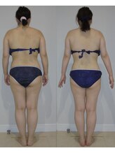 アルマ 芦屋(ALMA)/40代☆リジュ180分、スカルプ各5