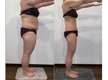 リリーパッソ(Lily passo)の雰囲気（痩身やボディメニューも☆バストと同時施術で効果ＵＰ！）