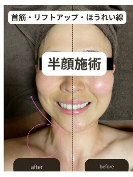 ニコノ(Nicono)/お顔の面積縮小！！