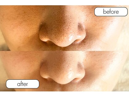 エン(YEN)の写真